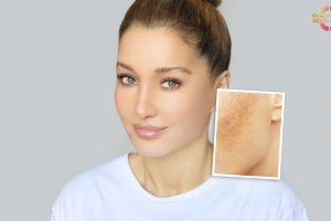 Melhor creme clareador de manchas: os 10 melhores de 2025