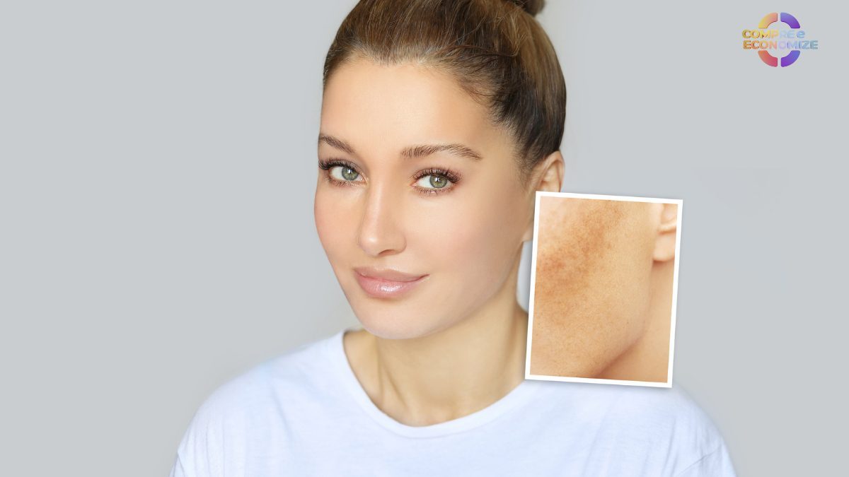 Melhor creme clareador de manchas: os 10 melhores de 2025